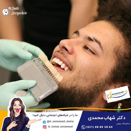 مقایسه قیمت لمینت دندان ۹۹ و کامپوزیت دندان ۹۹ - کلینیک دندانپزشکی دکتر شهاب محمدی